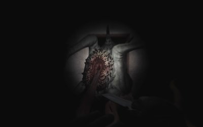 SCP: 5K